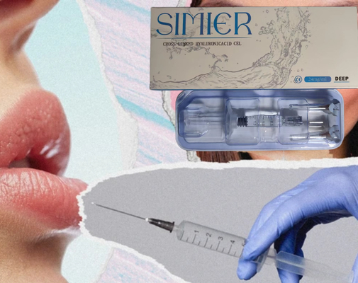 SIMIER 2ml アンチ・リュークス フェイス インジェクタブル ヒアルロン酸 皮膚充填剤