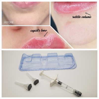 1ml Juvederm メディカル ナトリウムヒアルロナートゲル ヒアルロナ酸ゲル 鼻橋用