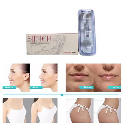 2ml クロスリンクドールマールフィラー 高HA濃度 24mg/Ml Anti wrinkles