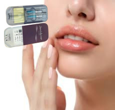 2 X 1ml Juvederm Ultra 4 皮膚充填剤 インジェクション 唇充填剤 インジェクション