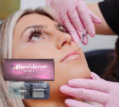 CE リップヒアルロン酸 注射用皮膚充填剤 Juvederm Ultra 3 Ultra 4 ボリューム