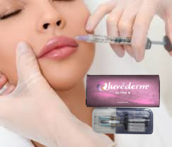 2 X 1ml Juvederm Ultra 4 皮膚充填剤 インジェクション 唇充填剤 インジェクション