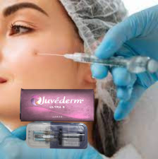 ナゾラビアル 折りたたみ 唇 2x1ml 皮膚充填剤 ヒアルロン酸 Juvederm Ultra3